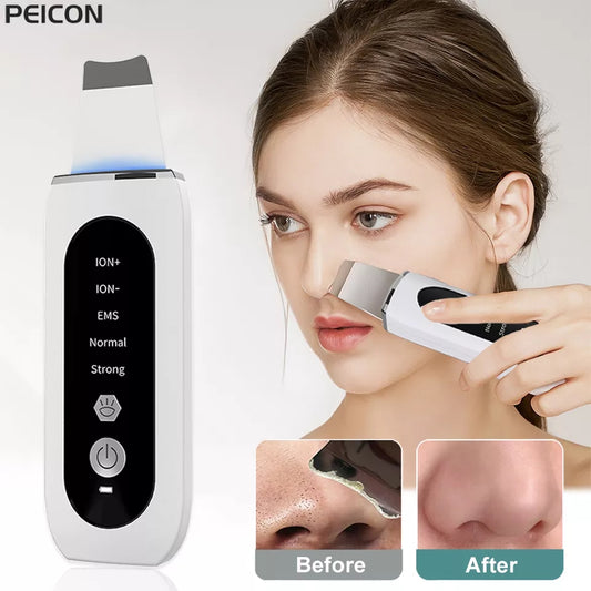 Ultrasonic Skin Scrubbern Ance Pore Cleaner Deep Face Cleaning